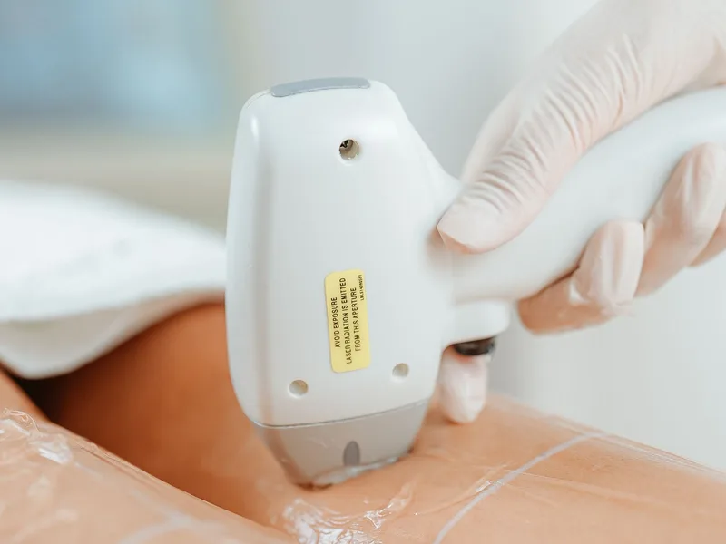 Epilazione laser a diodo — Estetica Beauty & Care