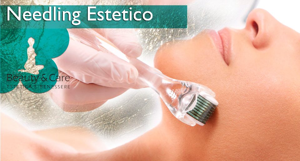 needling_estetico-beautycare-losone needling_estetico-beautycare-losone
