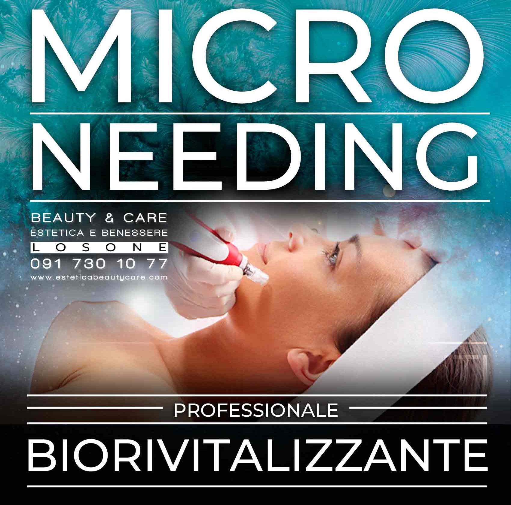 Estetica beauty_and_care losone MICRONEEDING 01