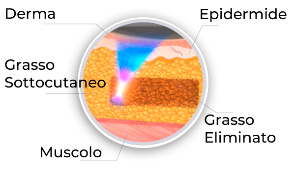 Estetica beauty_and_care losone TRATTAMENTO CORPO RIMODELLAMENTO 2025 01