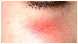 Estetica beauty_and_care losone Cambiamenti capillari 2025